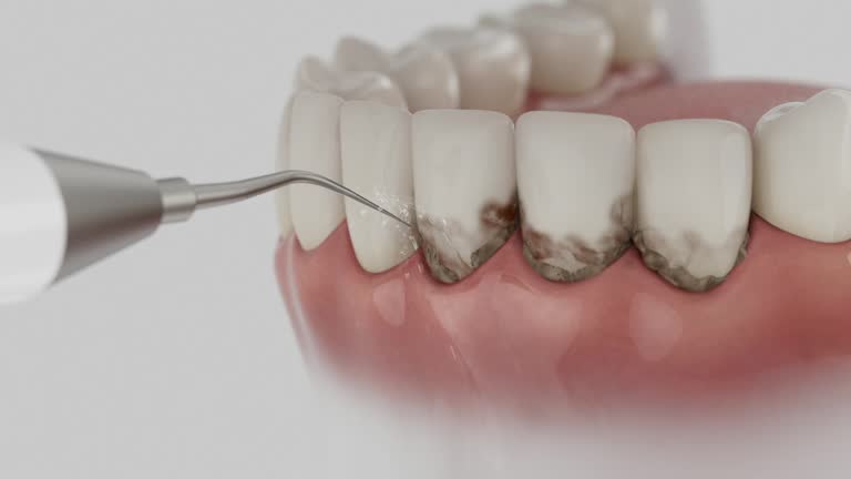 Reliable Teeth Cleaning And Checkup contractor in Stepney, CT by Smile Center Dentistry